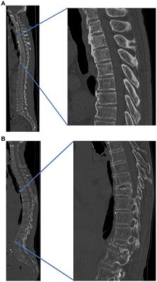 A view on the skin–bone axis: unraveling similarities and potential of crosstalk